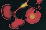 Epitope Tags